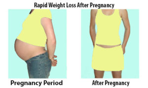 Rapid Weight Loss After Pregnancy